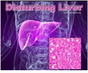 Disturbing liver logo