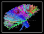 neuroplasticity logo