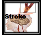 1st Strike Stroke logo