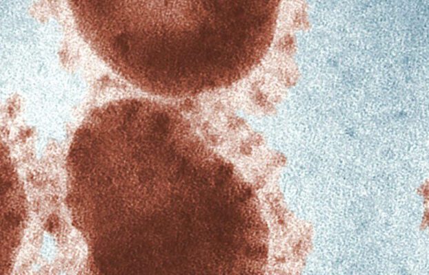 COVID – The subsequent Factors?